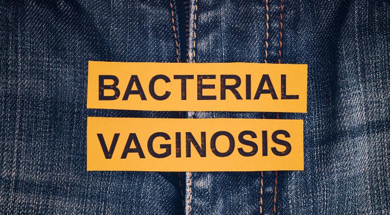 Bacterial Vaginosis Home Remedies – 10 Natural Solutions